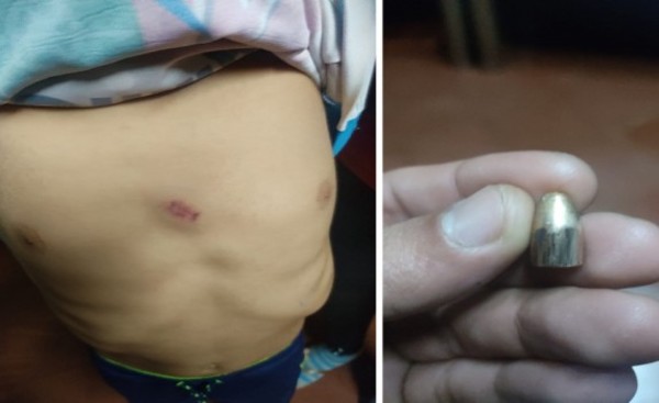Bala perdida cae sobre el pecho de niño dormido