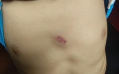 Niño se salva de milagro tras caerle una bala perdida