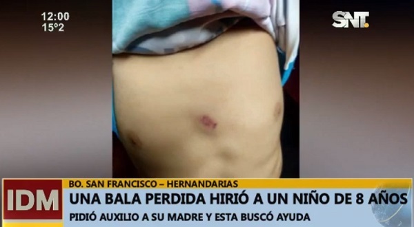Niño de ocho años sufre heridas por bala perdida