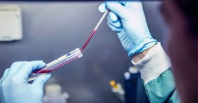 Descubren que una proteína en los glóbulos rojos ayuda a prevenir el envejecimiento del cerebro | Ñanduti