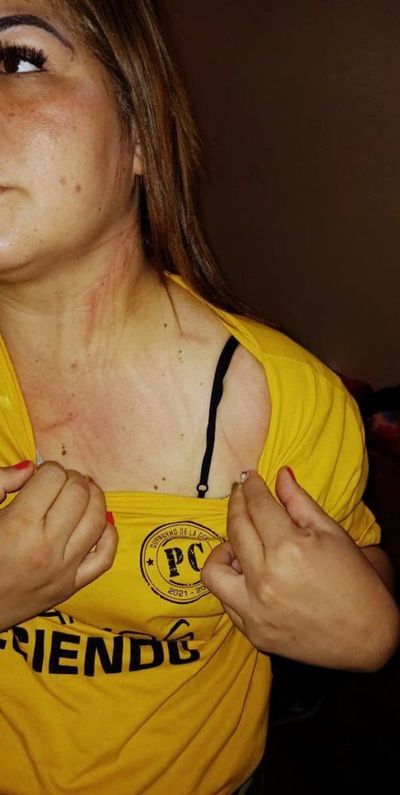 Funcionaria “garrotera” de Quyquyhó dijo que no renunciará al cargo de directora del Centro de Salud  - Nacionales - ABC Color
