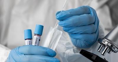 La Nación / COVID-19 interminable: británico estuvo infectado durante 10 meses