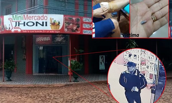 Dos bandidos balean a una comerciante y roban la recaudación del día, en km 7 – Diario TNPRESS