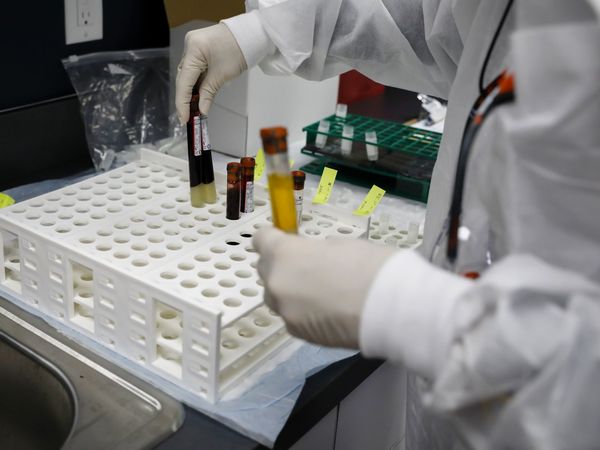 Río de Janeiro aprueba mezclar dosis de AstraZeneca y Pfizer para embarazadas | El Independiente