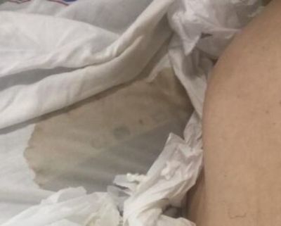 Falleció abuelo que había recibido supuesta mala atención en IPS