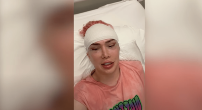 Gastó unos US$200 mil en cirugías plásticas para parecerse a una estrella de K-Pop