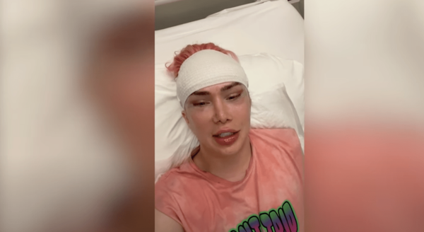 Gastó unos US$200 mil en cirugías plásticas para parecerse a una estrella de K-Pop