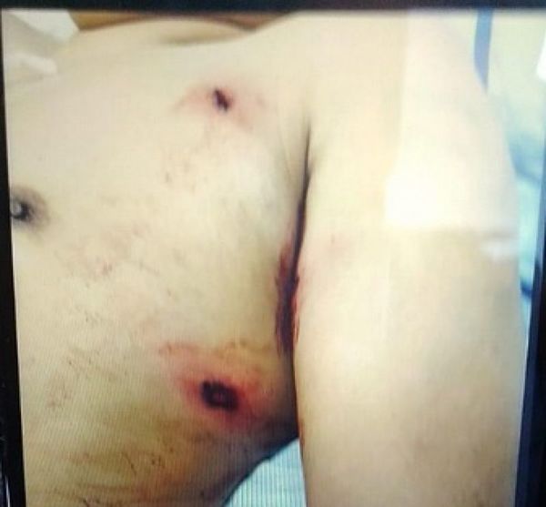 Atentan contra la vida de un hombre en el barrio Defensores del Chaco