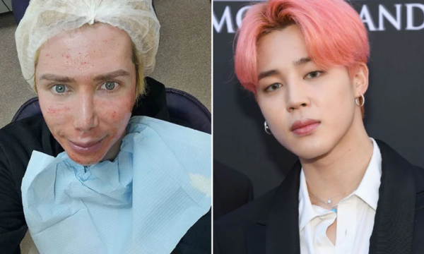 Influencer británico se operó 18 veces para parecerse a cantante de BTS