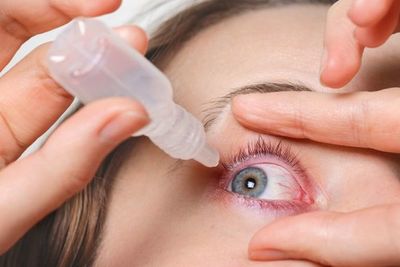 ¿Cómo prevenir la sequedad ocular en el invierno? - Estilo de vida - ABC Color