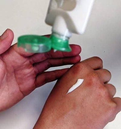 Diario HOY | Cómo cuidar la piel en épocas de frío