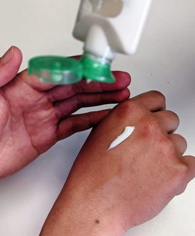 Cuidados de la piel en épocas de frío - Estilo de vida - ABC Color
