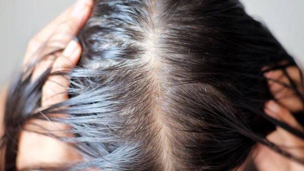 Recomendaciones para combatir la caída de cabello pos covid-19