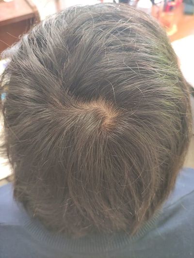 Post covid-19: brindan recomendaciones ante caída del pelo - Estilo de vida - ABC Color