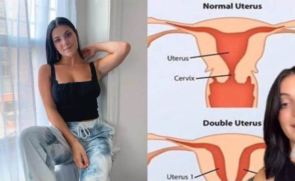 ¡Insólito! Conocé a Paige DeAngelo, la joven tiktoker que nació con dos úteros y dos vaginas