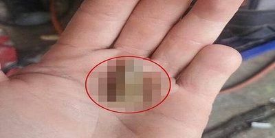 Se mutiló su dedo meñique y mirá lo que pasó después
