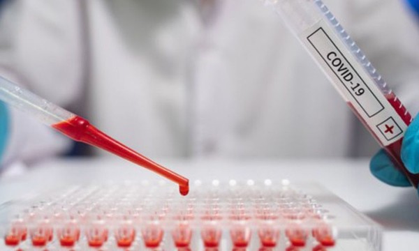 Covid-19: Paraguay con capacidad de investigar nuevas variantes - OviedoPress