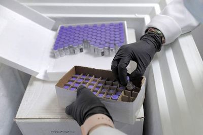 Estudio señala que anticuerpos del COVID-19 persisten 9 meses tras infección - Mundo - ABC Color