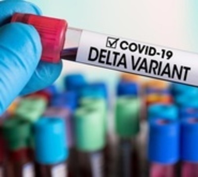 Inmunidad a variante Gamma podría reducir riesgo de la Delta - Paraguay.com