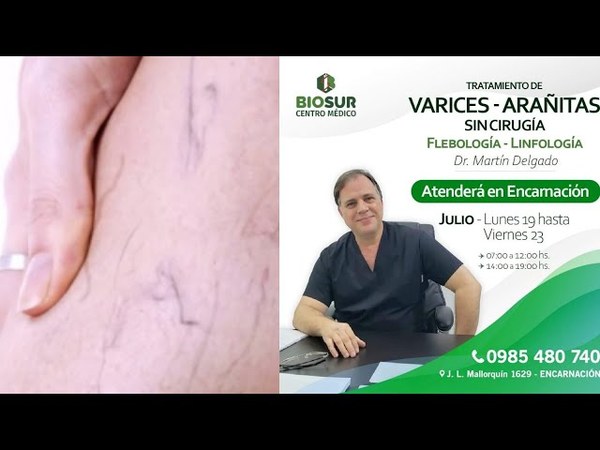 TODA ESTA SEMANA, EL DR. MARTÍN DELGADO ATENDERÁ EN ENCARNACIÓN