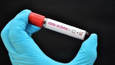 Detectan posible variante Delta de COVID-19 en el país