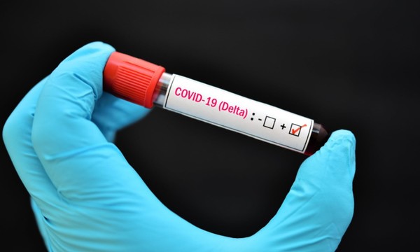 COVID-19: Laboratorio de la UNA identificó ingreso de la variante delta - C9N
