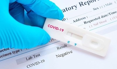 Los anticuerpos del COVID persisten unos nueve meses tras una infección, según estudio | Ñanduti