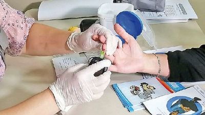 “Diabetes y coronavirus”, tema que tratarán hoy en congreso