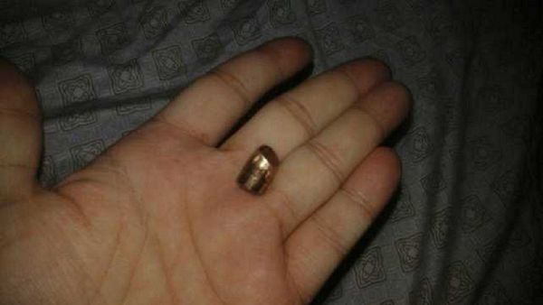 Bala perdida traspasó techo e hirió de refilón a una joven