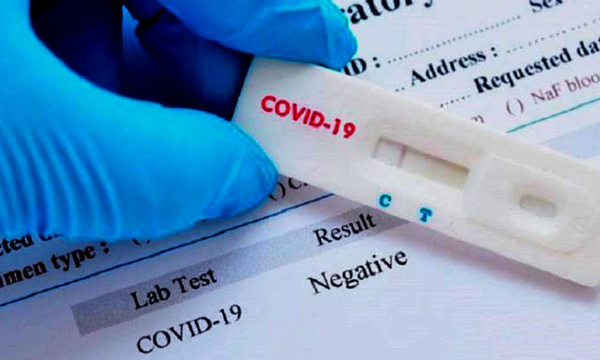Salud recibió más de 18.000 tests rápidos de COVID-19 - OviedoPress