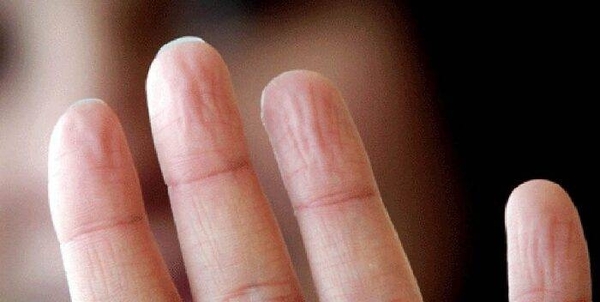 Diario HOY | Científicos de EEUU avanzan en prótesis con "yemas" que sienten las texturas