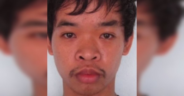 Joven fue rechazado en un trabajo por su aspecto, se operó 9 veces el rostro y ahora luce irreconocible - SNT