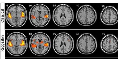 ¡Sorprendente! El reguetón genera más actividad cerebral que oír música clásica