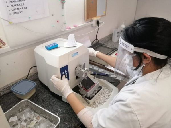 Covid-19: Salud reporta 58 muertes y 592 nuevos casos
