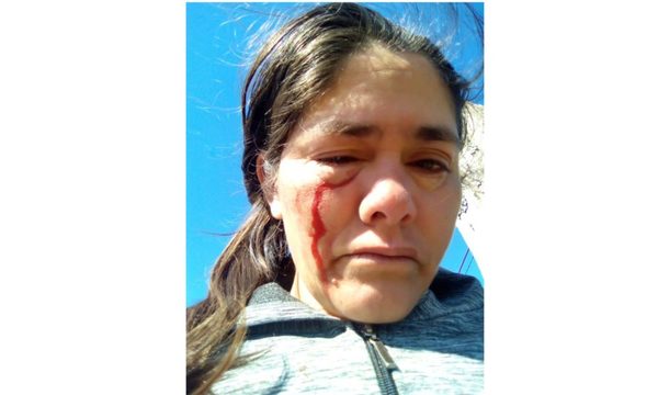Golpeó a su pareja tras descubrir que estaba revisando sus mensajes