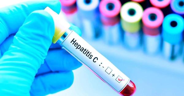 Hepatitis: ¡Se puede prevenir y tratar a tiempo! – Prensa 5