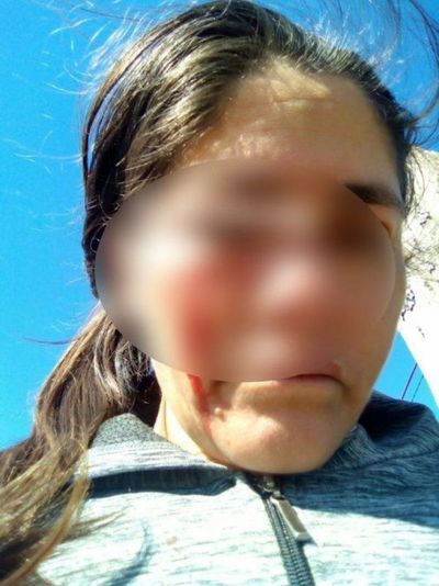 Le rompió la cara con el celular a su concubina porque miró su WhatsApp