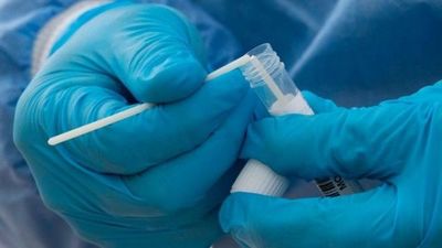 Coronavirus: 61 muertos y 664 contagiados