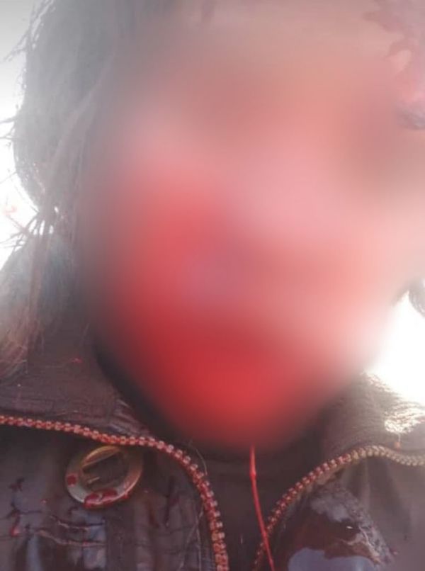Denunciado por violencia familiar es buscado por presuntamente apuñalar a su ex pareja