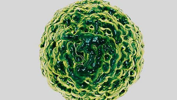 ¡Alerta! ¿Qué es el norovirus y por qué genera preocupación a escala mundial?