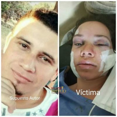 Imputan a sujeto que intento asesinar a su ex pareja en el asentamiento San Francisco