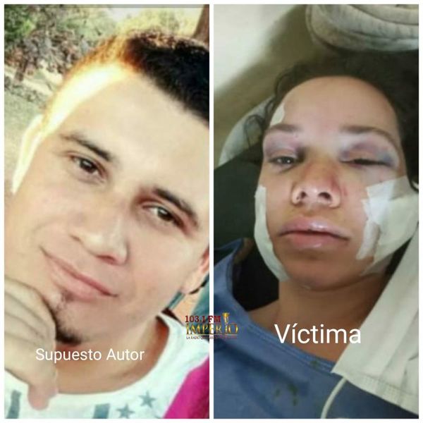 Imputan a sujeto que intento asesinar a su ex pareja en el asentamiento San Francisco