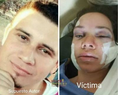 Imputan a sujeto que intentó asesinar a su ex pareja en el asentamiento San Francisco