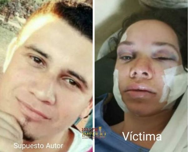Imputan a sujeto que intentó asesinar a su ex pareja en el asentamiento San Francisco