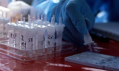Covid-19: Paraguay podrá monitorear el ingreso y la circulación de las variantes - OviedoPress