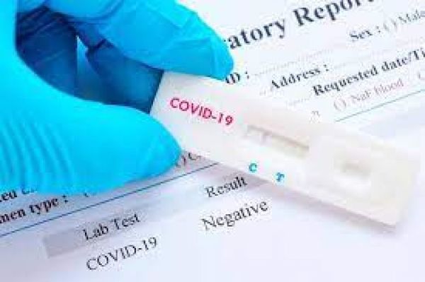 Salud reporta 44 muertes y 333 nuevos casos de Covid-19
