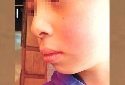 Crónica / “Su profesor le pegaba por la cara”, he’i doña