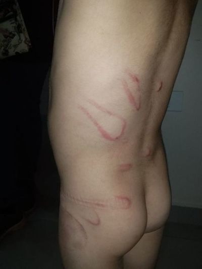 Imputan a desalmada madre por brutal golpiza a su hijo de 4 años en Minga Guazú