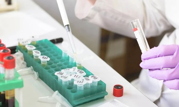 Proyecciones epidemiológicas muestran descenso, pero alertan aumento de casos para el 2022 - OviedoPress