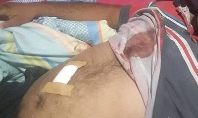 Hombre denuncia a su ex pareja por violencia – Prensa 5